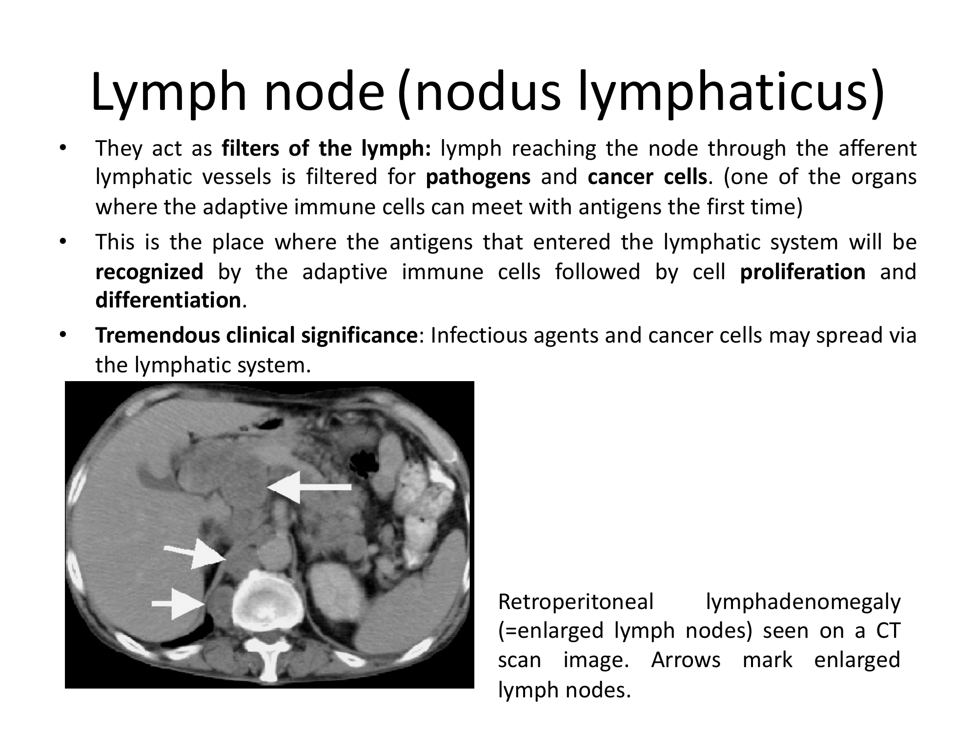 Before: Original slide 20 — lymph node text and CT scan