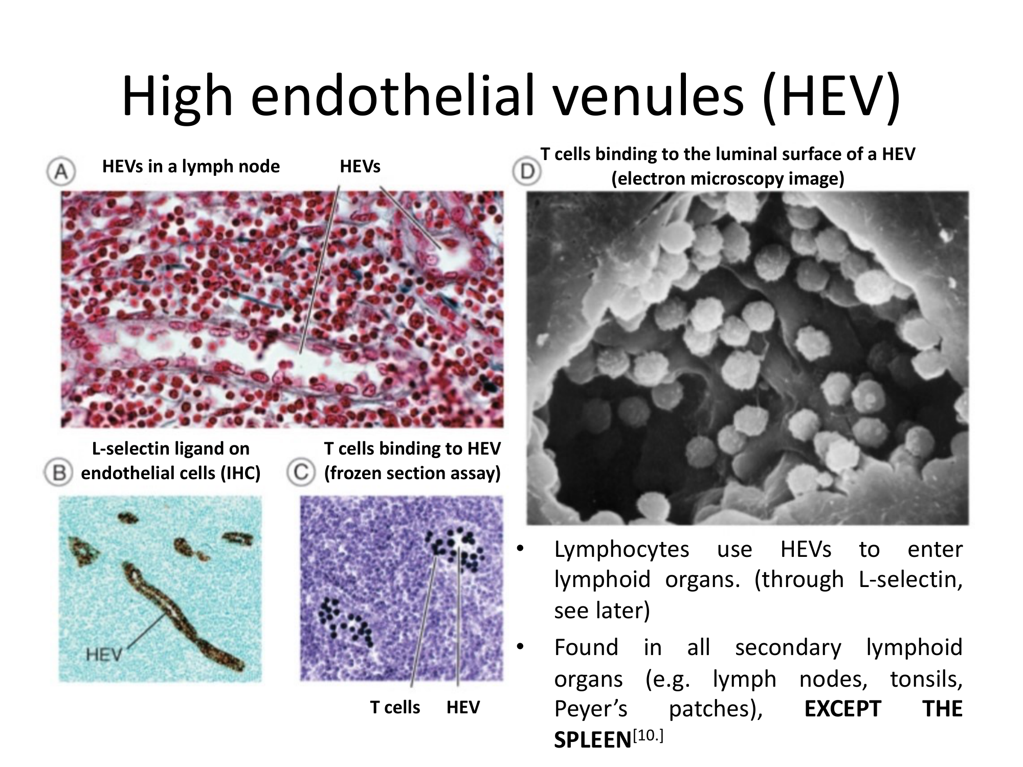 Before: Original slide 25 — multiple HEV microscopy images