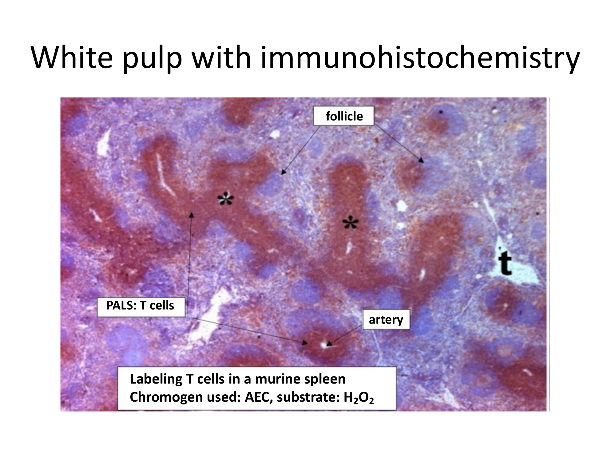 Before: Original slide 31 — white pulp immunohistochemistry