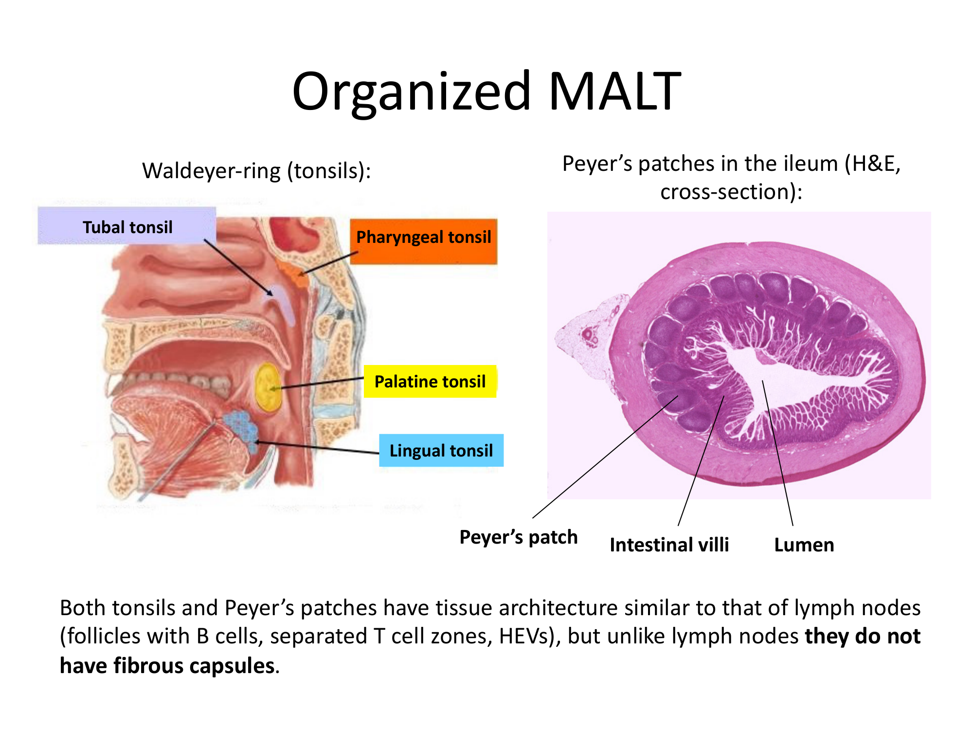 Before: Original slide 34 — Waldeyer ring and Peyer's patches