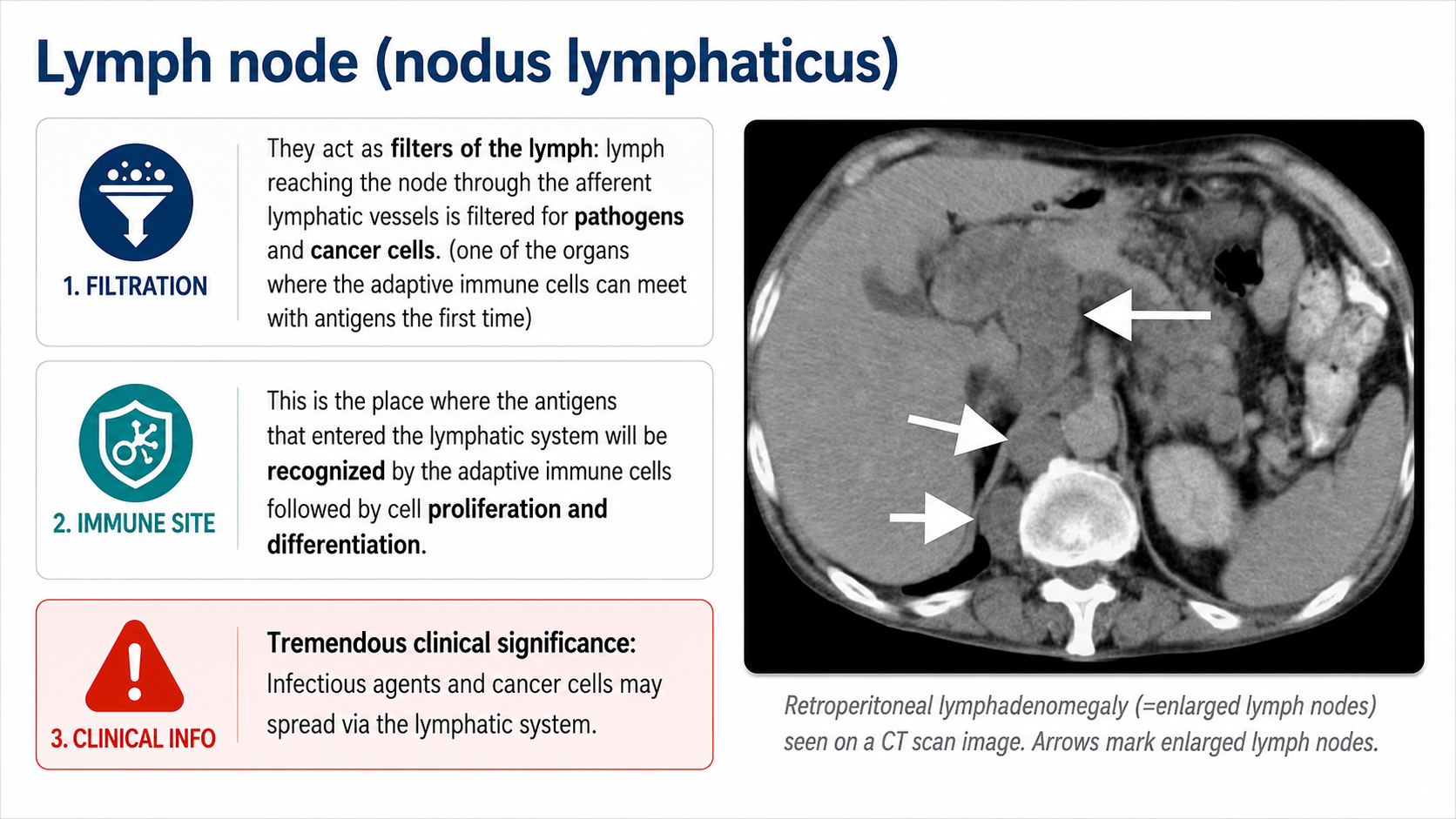 After: Redesigned slide 20 with AI-generated lymph node illustration