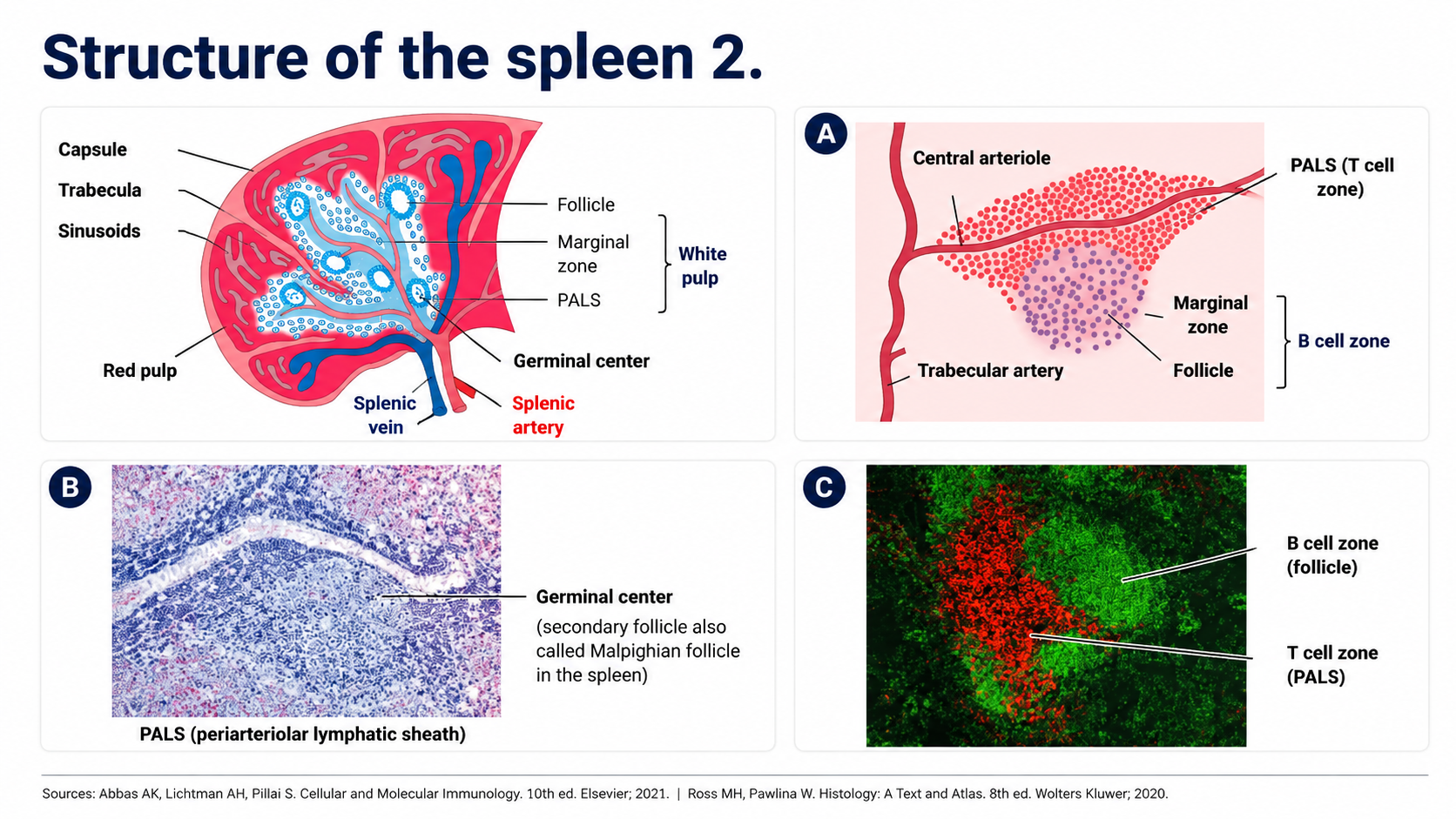 After: Redesigned slide 30 with organized spleen microscopy panel