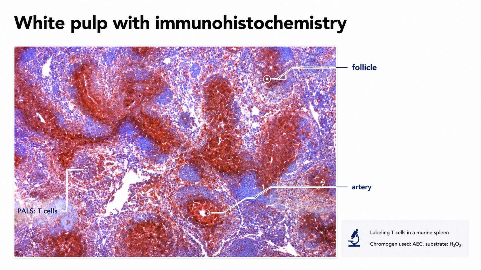 After: Redesigned slide 31 with annotated white pulp microscopy