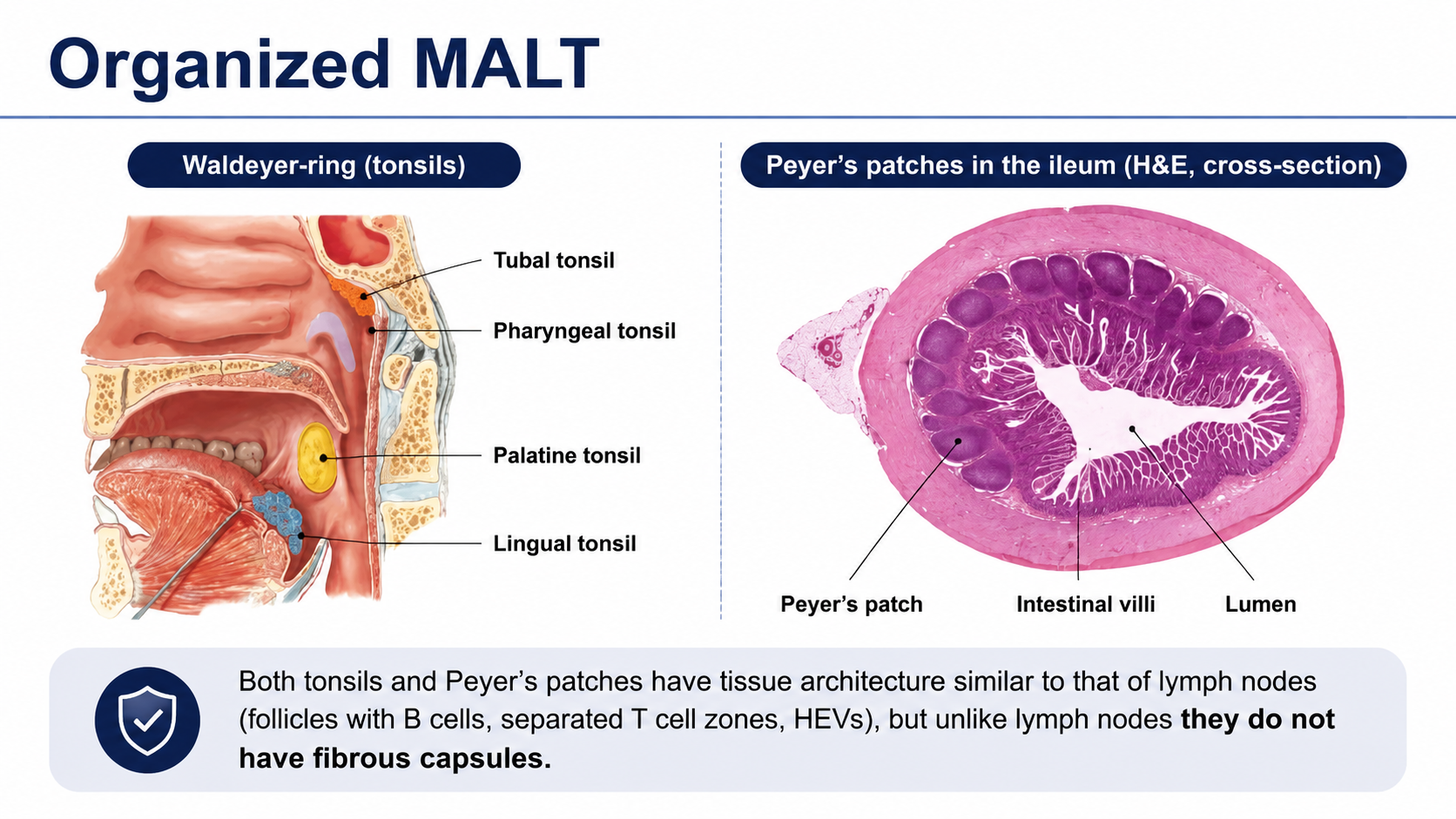After: Redesigned slide 34 with AI Waldeyer ring and Peyer's patch illustrations