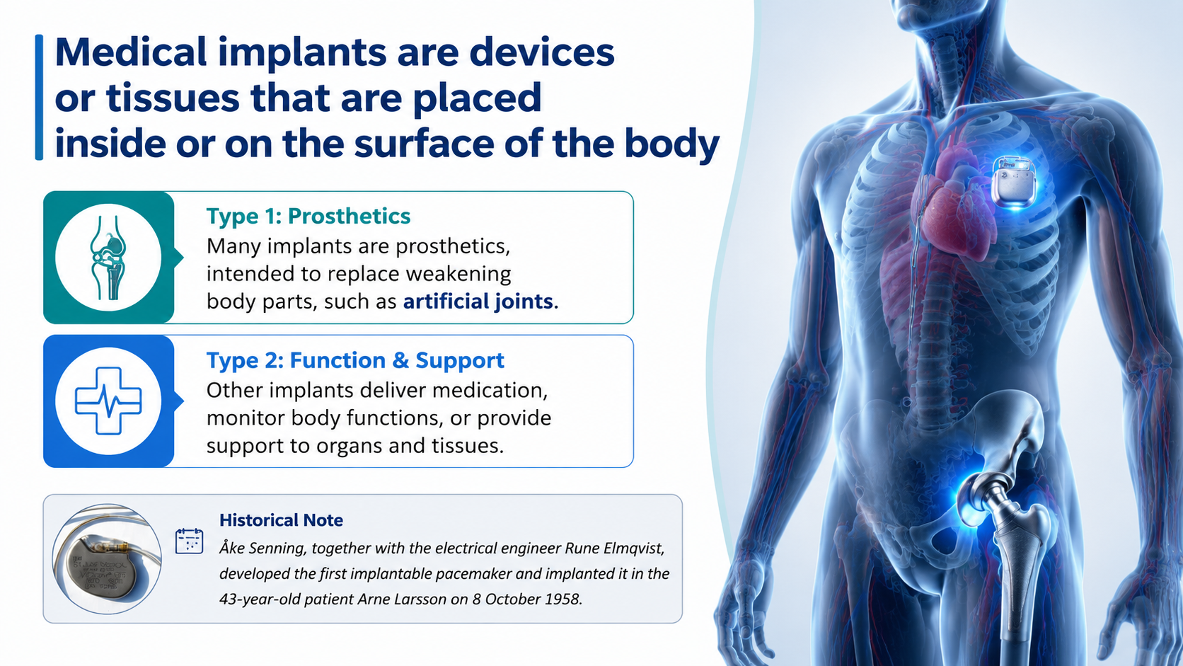 After: Redesigned slide 2 with anatomical figure and organized implant type cards